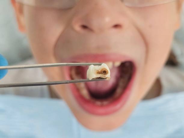 Best Emergency Dental Surgery in Brightwood, VA