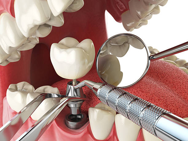 Best Emergency Orthodontic Repairs in Brightwood, VA