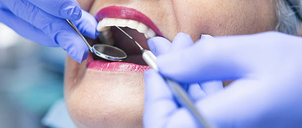 Best Emergency Tooth Extraction in Brightwood, VA