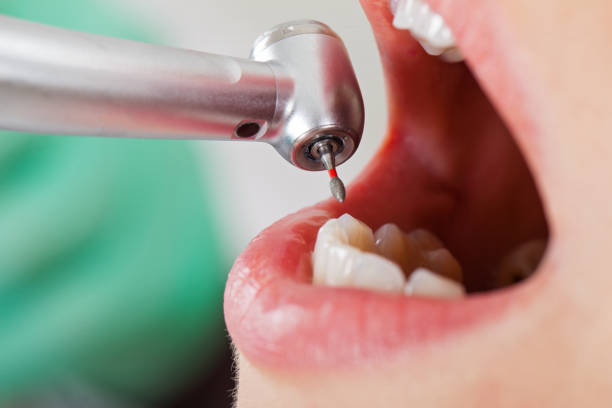 Best Emergency Treatment for Toothache in Brightwood, VA